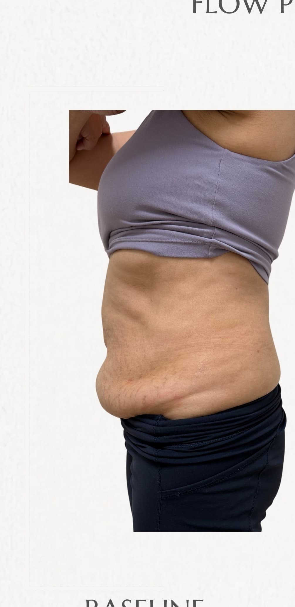 Flow Physique member — before