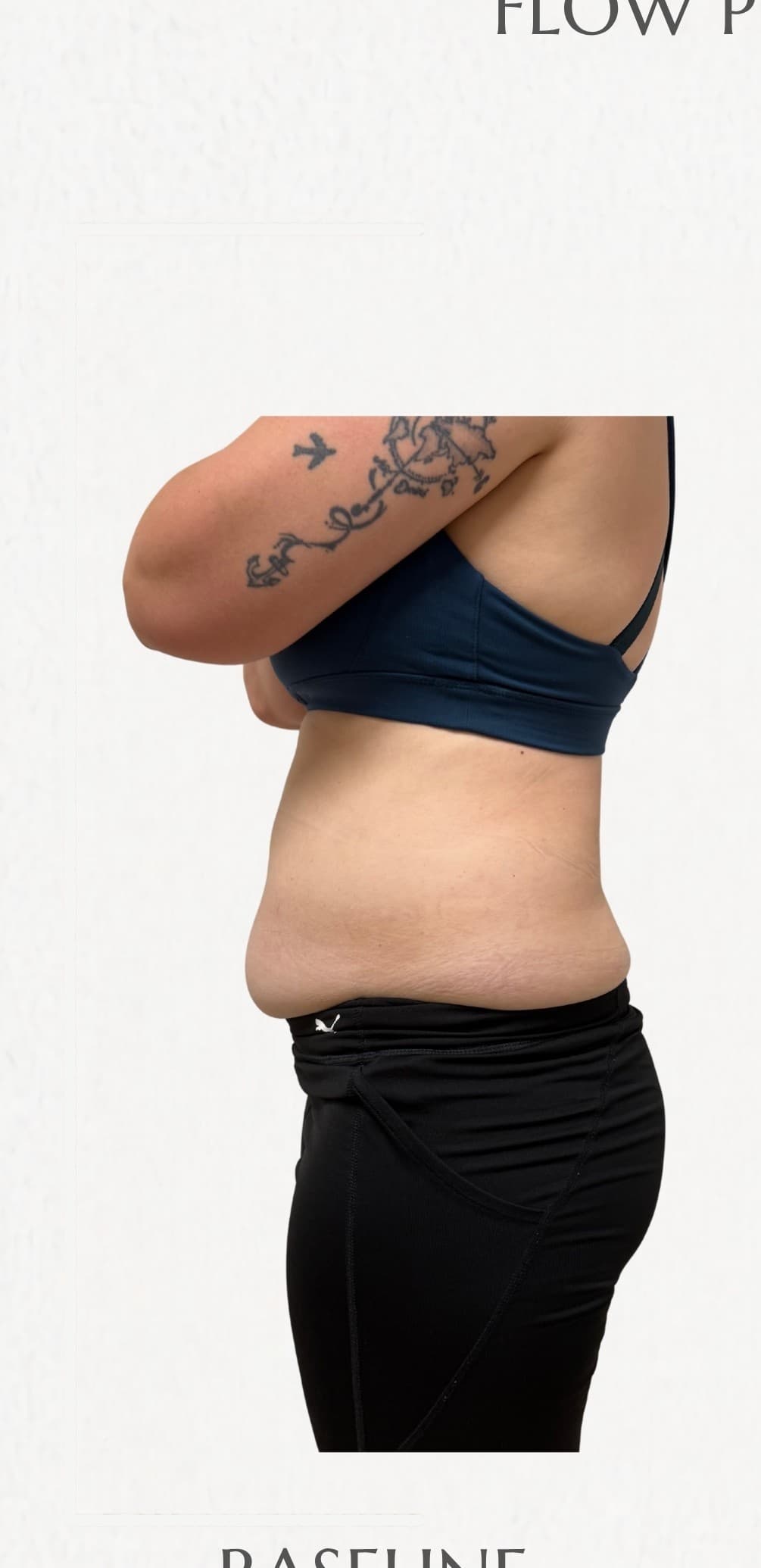 Flow Physique member — before