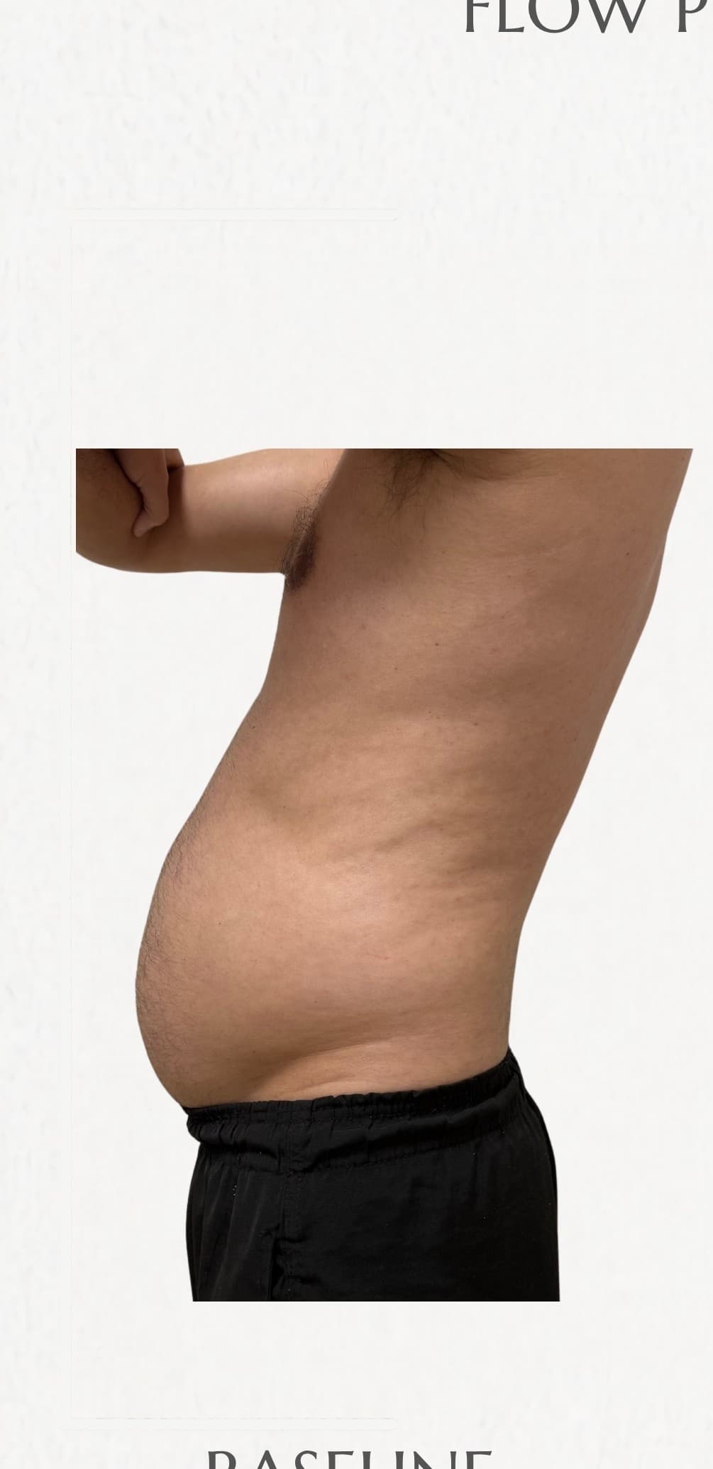 Flow Physique member — before