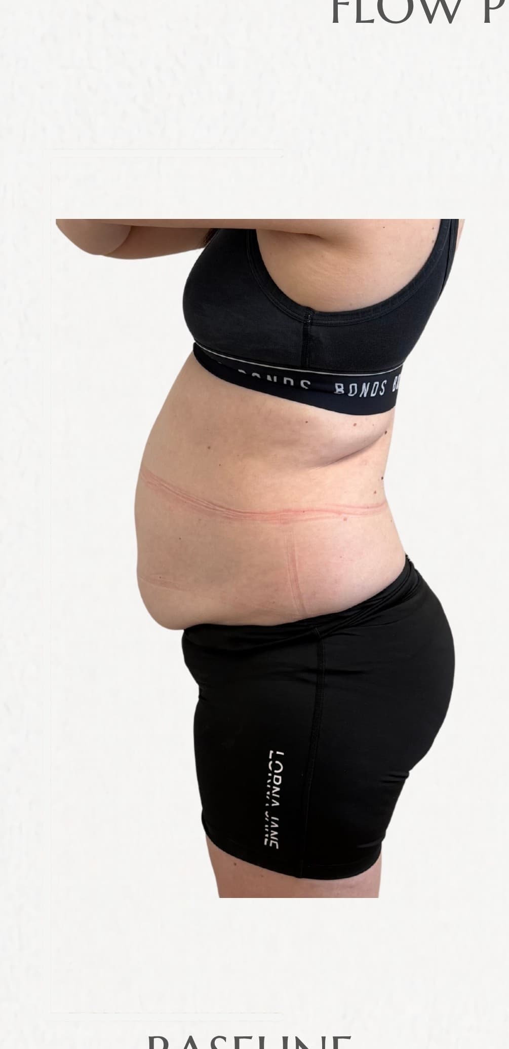 Flow Physique member — before