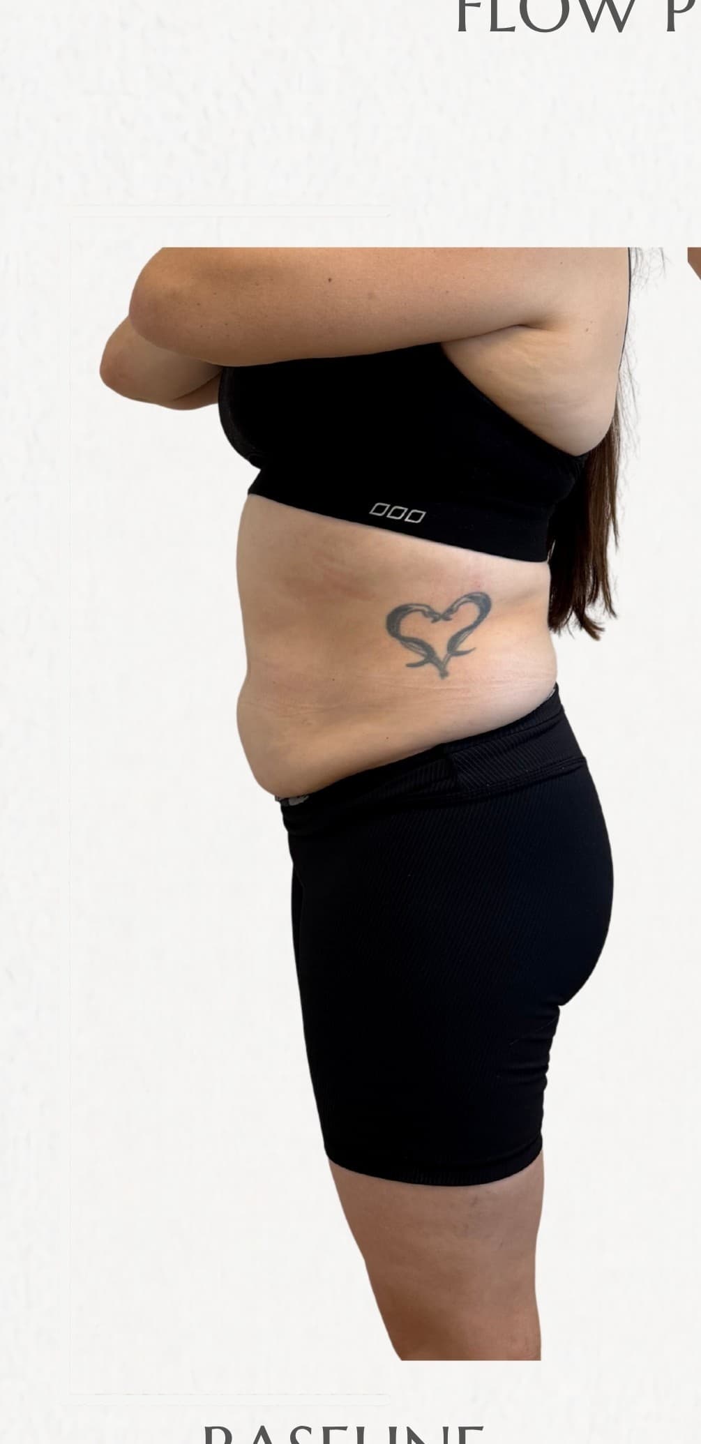Flow Physique member — before