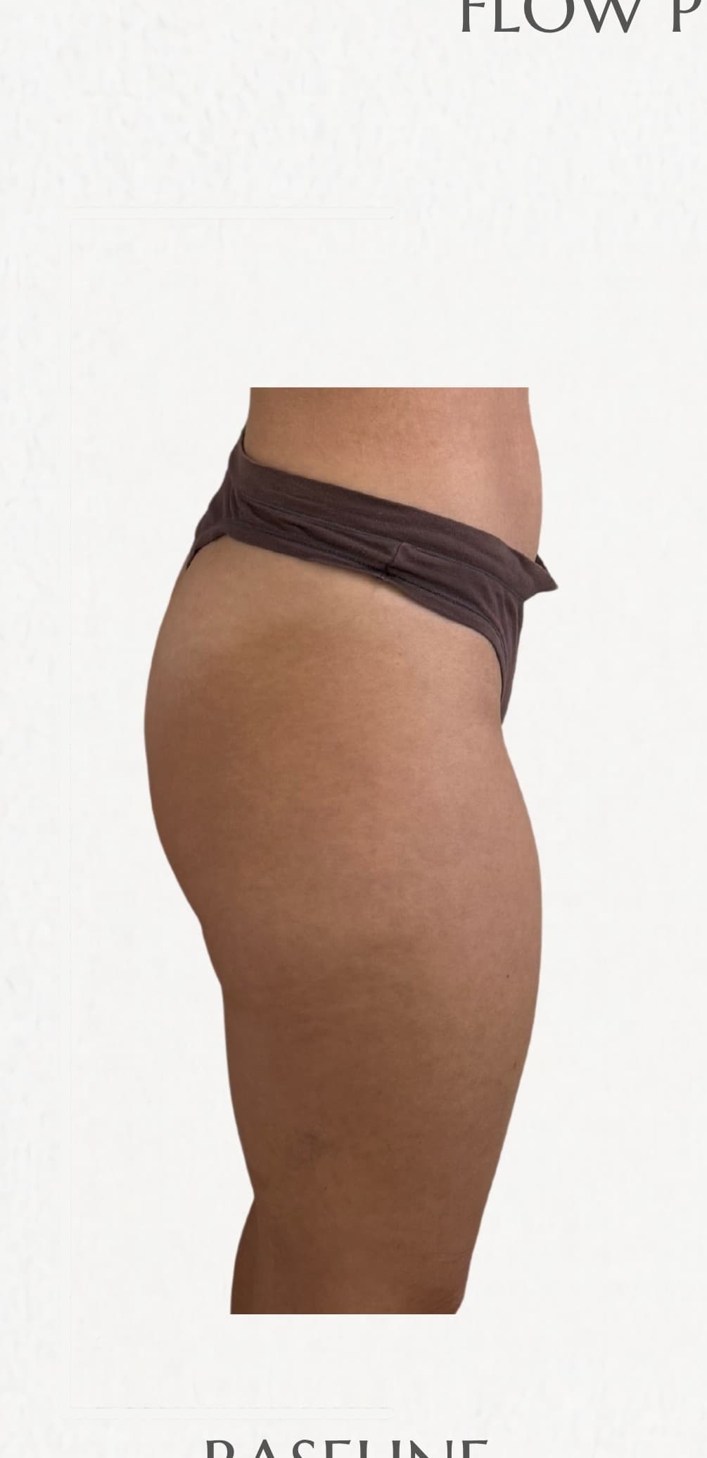 Flow Physique member — before